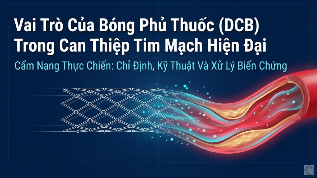 /img/news/full_timmachcanthiep_nghien-cuu-ocvc-bif-20266122234.jpeg